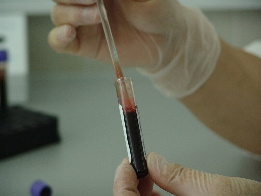 위암을 검사 중인 연구원